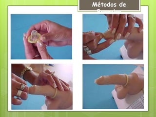 Métodos de
 Barreira
 