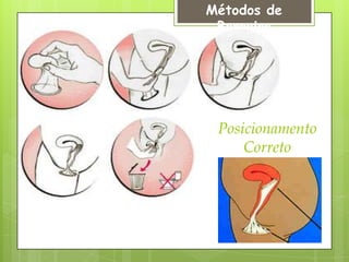 Métodos de
 Barreira




 Posicionamento
     Correto
 