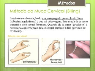 Métodos
                   Naturais
Método do Muco Cervical (Billing)
Baseia-se na observação do muco segregado pelo colo do útero
(substância gelatinosa) e que sai pela vagina. Este muda de aspecto
durante o ciclo sexual feminino. Quando ele se torna “grudento” é
necessária a interrupção do ato sexual durante 4 dias (período de
ovulação).
 