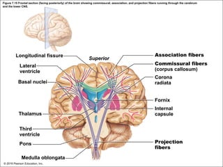 Figure 7.15 Frontal section (facing posteriorly) of the brain showing commissural, association, and projection fibers running through the cerebrum
and the lower CNS.
Longitudinal fissure
Lateral
ventricle
Basal nuclei
Superior
Association fibers
Commissural fibers
(corpus callosum)
Corona
radiata
Fornix
Thalamus
Third
ventricle
Pons
Medulla oblongata
Internal
capsule
Projection
fibers
© 2018 Pearson Education, Inc.
 