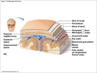 Figure 7.17a Meninges of the brain.
Skin of scalp
Periosteum
Bone of skull
Periosteal
Meningeal
Dura
mater
Superior
sagittal sinus
Subdural
space
Subarachnoid
space
(a)
Arachnoid mater
Pia mater
Arachnoid granulation
Blood
vessel
Falx cerebri
(in longitudinal
fissure only)
© 2018 Pearson Education, Inc.
 