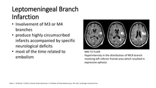 Mca & aca syndromes | PPTX