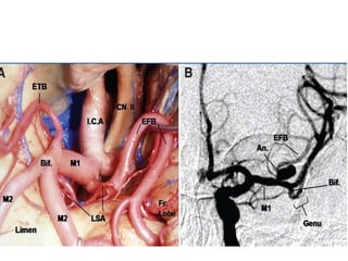 middle cerebral artery anatomy | PPTX