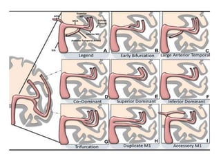 middle cerebral artery anatomy | PPTX