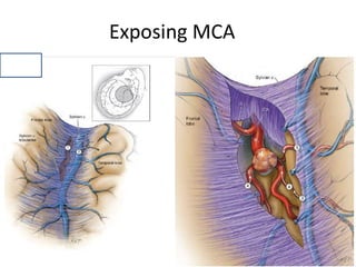 middle cerebral artery anatomy | PPTX