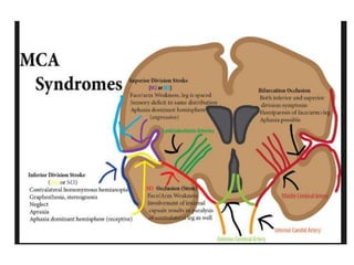 middle cerebral artery anatomy | PPTX