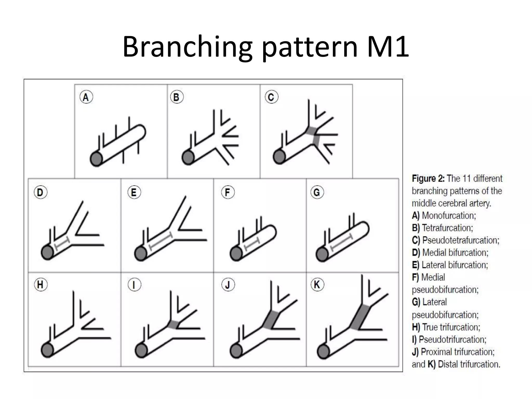 Branching pattern M1
 