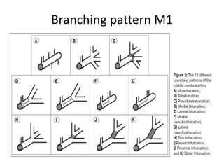 Branching pattern M1
 