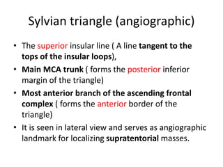 Sylvian triangle (angiographic)
• The superior insular line ( A line tangent to the
tops of the insular loops),
• Main MCA trunk ( forms the posterior inferior
margin of the triangle)
• Most anterior branch of the ascending frontal
complex ( forms the anterior border of the
triangle)
• It is seen in lateral view and serves as angiographic
landmark for localizing supratentorial masses.
 