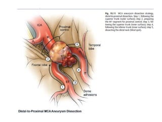 Mca anatomy