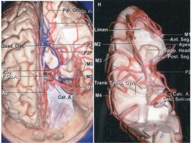 Mca Anatomy Mca Anatomy
