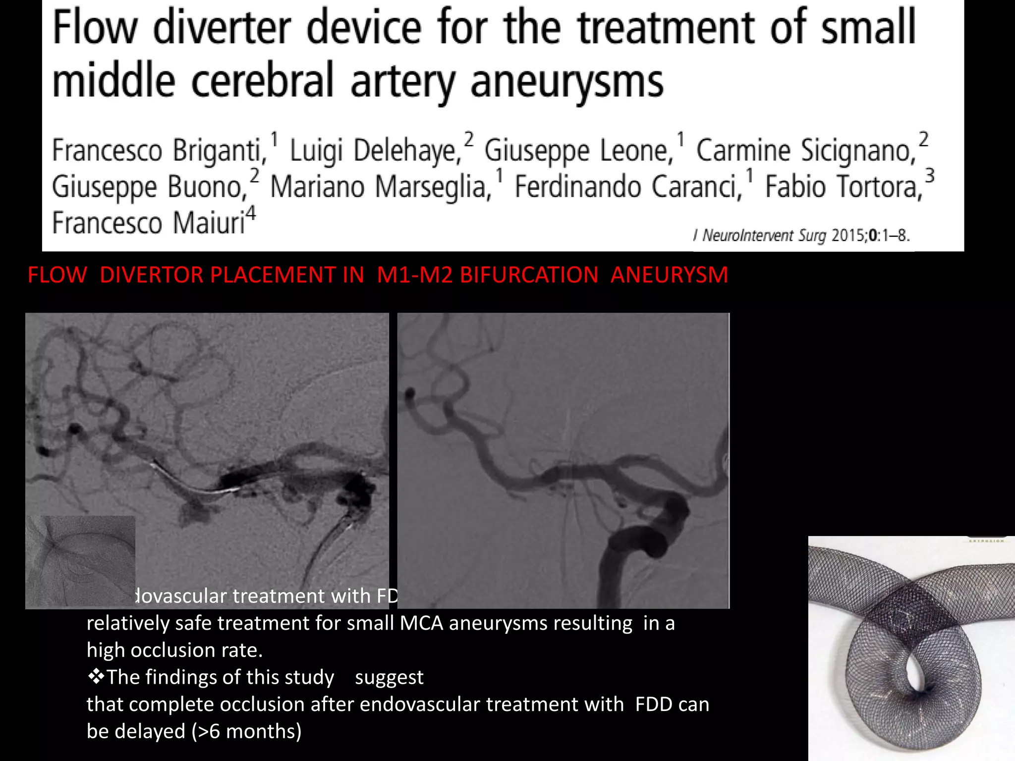 Clipping or Coiling for MCA Aneurysm | PDF