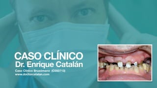 CASO CLÍNICO
Dr. Enrique Catalán
Caso Clínico Bruxómano (C050713)
www.doctorcatalan.com
 