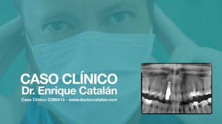 CASO CLÍNICO
Dr. Enrique Catalán
Caso Clínico C090413 - www.doctorcatalan.com
 