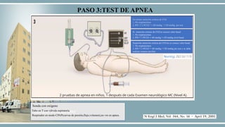MUERTE ENCEFALICA EN PEDIATRIA , PRESENTACION | PPTX