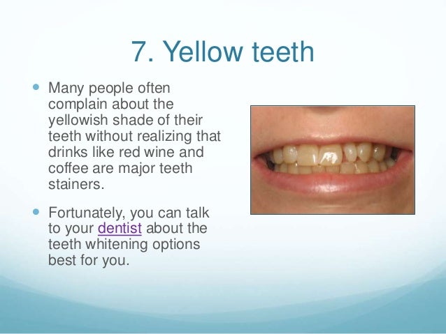 mouth problem yellow Most Problems 8 Dental Common mouth problem yellow Most Problems 8 Dental Common