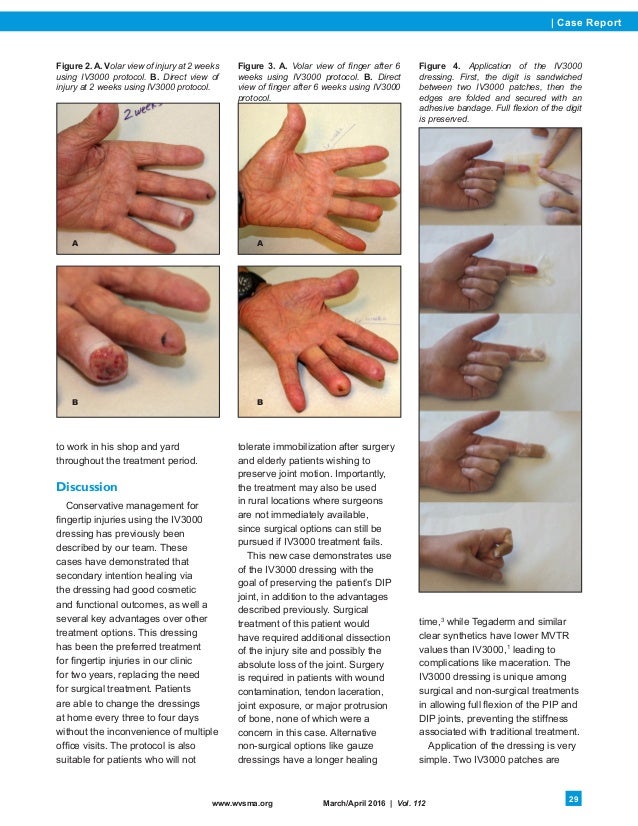 IV3000 Dressing for Fingertip Injuries