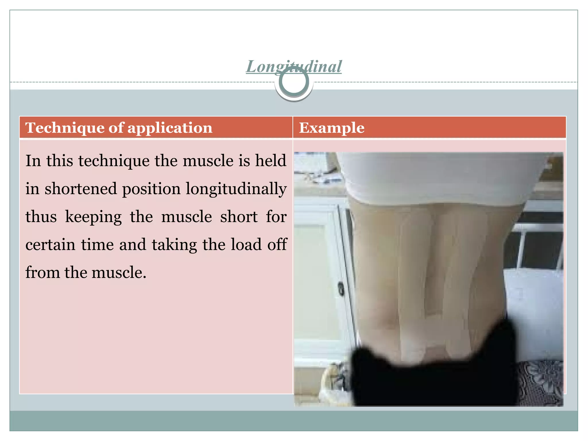 Longitudinal
Technique of application Example
In this technique the muscle is held
in shortened position longitudinally
thus keeping the muscle short for
certain time and taking the load off
from the muscle.
 
