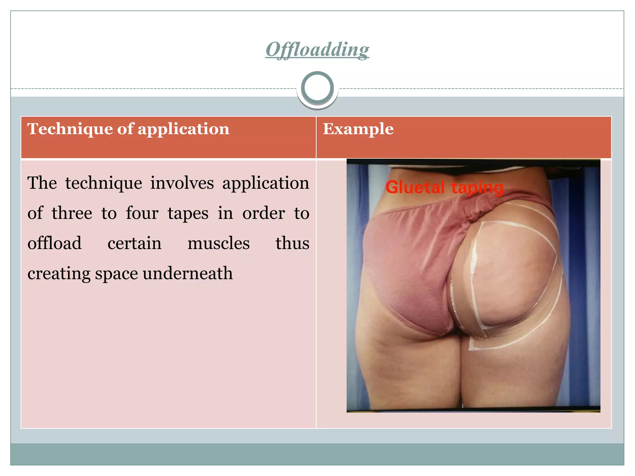 Offloadding
Technique of application Example
The technique involves application
of three to four tapes in order to
offload certain muscles thus
creating space underneath
 