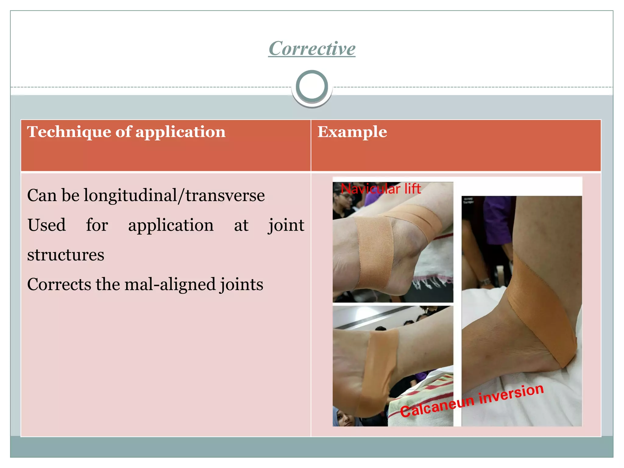 Corrective
Technique of application Example
Can be longitudinal/transverse
Used for application at joint
structures
Corrects the mal-aligned joints
 
