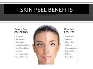 - SKIN PEEL BENEFITS -
 