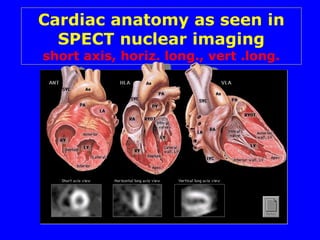 Cardiac anatomy as seen in SPECT nuclear imaging short axis, horiz. long., vert .long. 