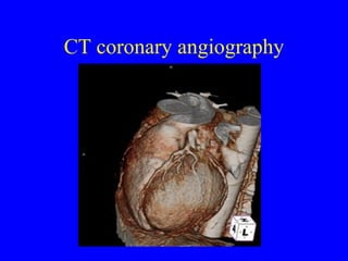 CT coronary angiography 