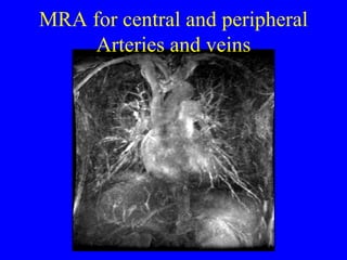 MRA for central and peripheral Arteries and veins 