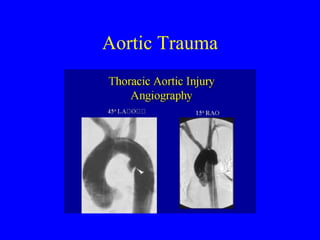 Aortic Trauma 