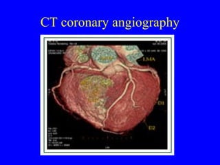 CT coronary angiography 