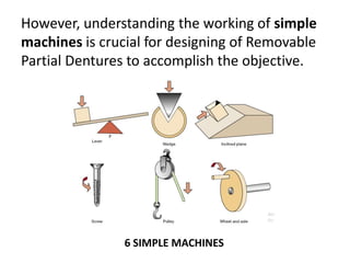 However, understanding the working of simple
machines is crucial for designing of Removable
Partial Dentures to accomplish the objective.
6 SIMPLE MACHINES
 