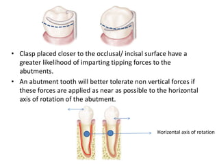 • Clasp placed closer to the occlusal/ incisal surface have a
greater likelihood of imparting tipping forces to the
abutments.
• An abutment tooth will better tolerate non vertical forces if
these forces are applied as near as possible to the horizontal
axis of rotation of the abutment.
Horizontal axis of rotation
 