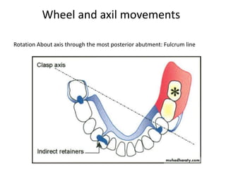 Rotation About axis through the most posterior abutment: Fulcrum line
Wheel and axil movements
 