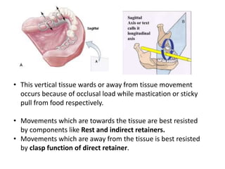 • This vertical tissue wards or away from tissue movement
occurs because of occlusal load while mastication or sticky
pull from food respectively.
• Movements which are towards the tissue are best resisted
by components like Rest and indirect retainers.
• Movements which are away from the tissue is best resisted
by clasp function of direct retainer.
 