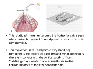 • This rotational movement around the horizontal axis is seen
when horizontal support from ridge and other structures is
compromised.
• This movement is resisted primarily by stabilizing
components like reciprocal clasp arm and minor connectors
that are in contact with the vertical tooth surfaces.
Stabilizing components of one side will stabilize the
horizontal forces of the other opposite side.
 