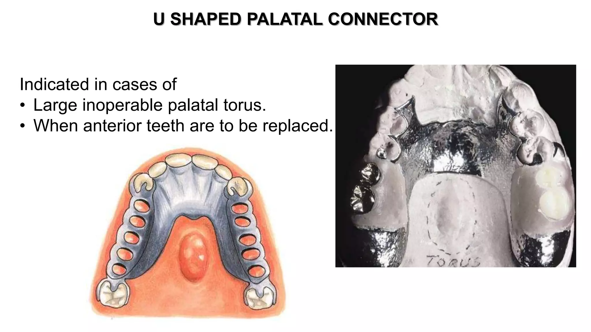 Major and Minor Connectors | PPTX