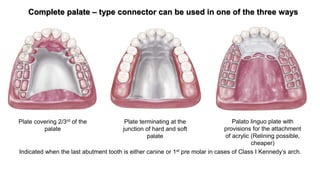 Major and Minor Connectors | PPT