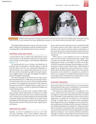 Long Box Rests For Rotational Path Rpd Comprehensive Guide to Removable Partial Prosthodontics: Design ...