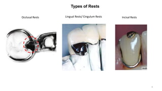 McCracken's Chapter 6 Rest and Rest Seats | PPTX