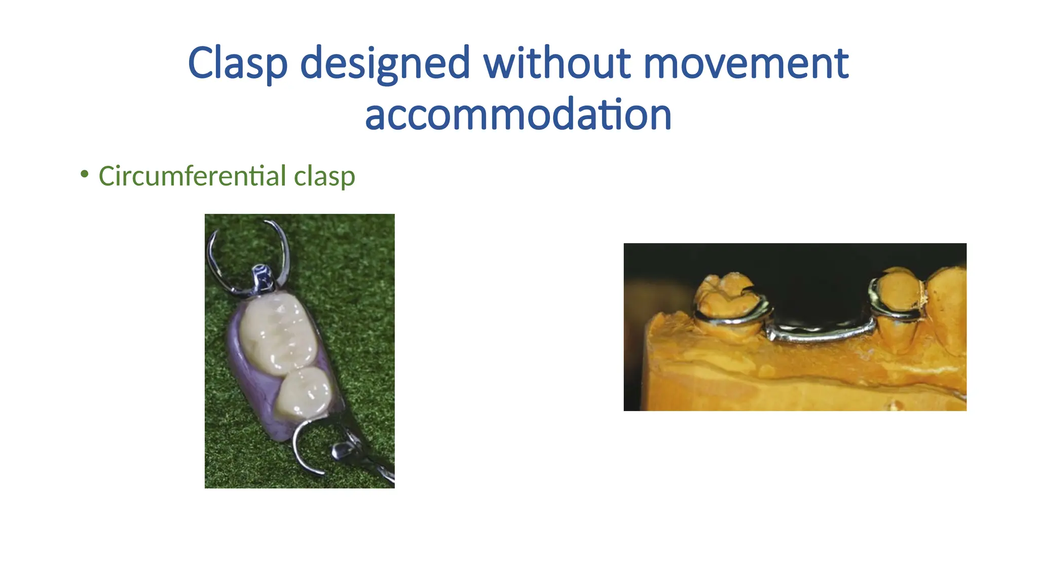 • Circumferential clasp
Clasp designed without movement
accommodation
 