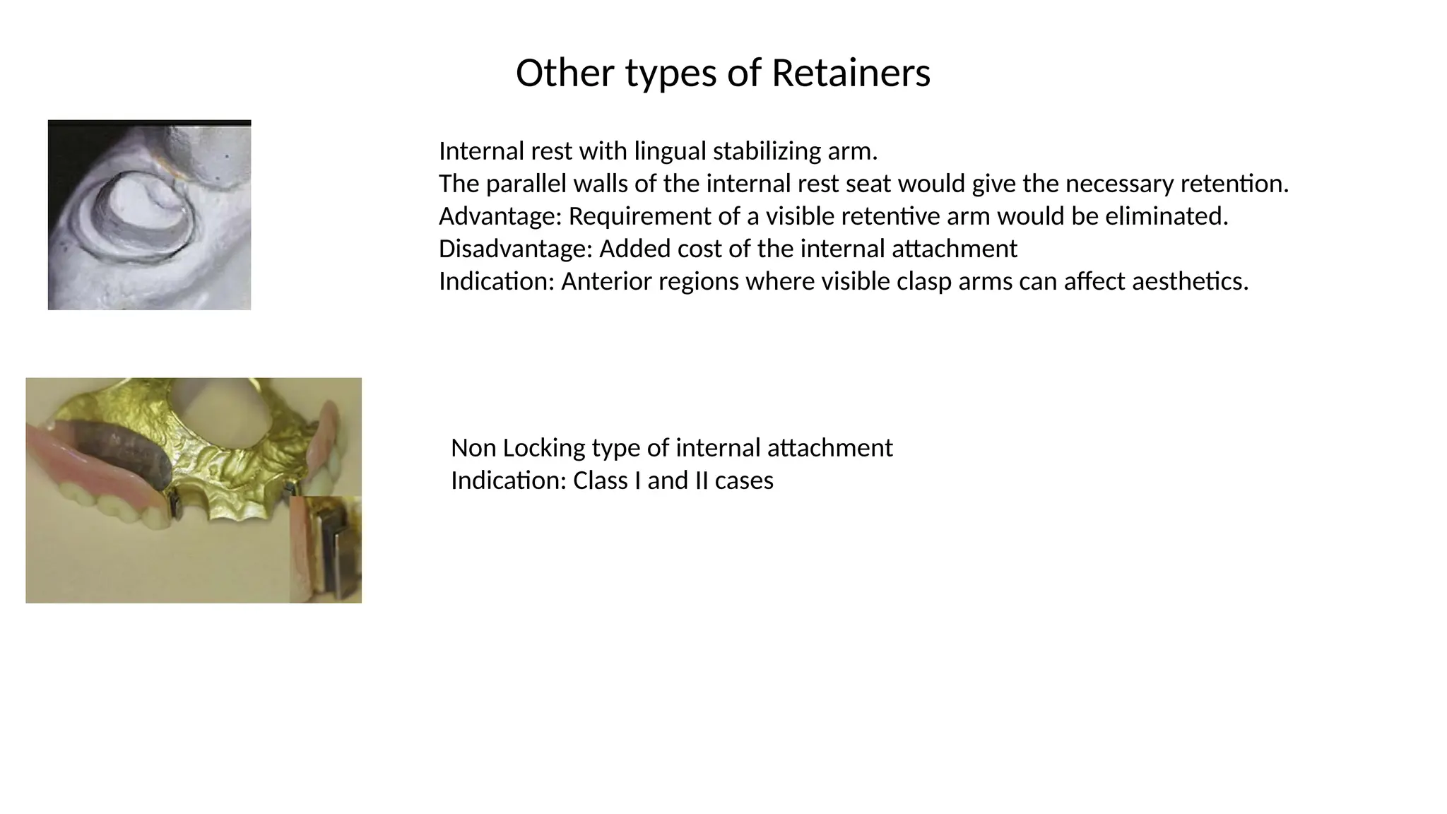 Other types of Retainers
Internal rest with lingual stabilizing arm.
The parallel walls of the internal rest seat would give the necessary retention.
Advantage: Requirement of a visible retentive arm would be eliminated.
Disadvantage: Added cost of the internal attachment
Indication: Anterior regions where visible clasp arms can affect aesthetics.
Non Locking type of internal attachment
Indication: Class I and II cases
 
