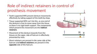 Holding Rpd Retainer McCracken's Chapter 8 Indirect Retainers | PPTX