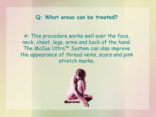 Q: What areas can be treated? A: This procedure works well over the face, neck, chest, legs, arms and back of the hand. The McCue Ultra™ System can also improve the appearance of thread veins, scars and pink stretch marks. 