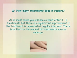 Q: How many treatments does it require? A: In most cases you will see a result after 4 - 6 treatments but there is a significant improvement if the treatment is repeated at regular intervals. There is no limit to the amount of treatments you can undergo. 