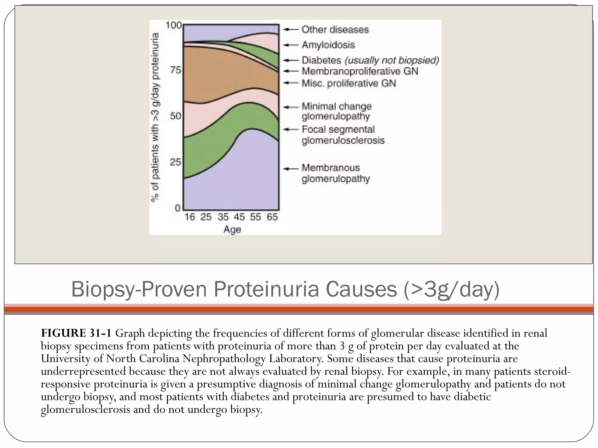 Biopsy-Proven Proteinuria Causes (>3g/day)
FIGURE 31-1 Graph depicting the frequencies of different forms of glomerular disease identified in renal
biopsy specimens from patients with proteinuria of more than 3 g of protein per day evaluated at the
University of North Carolina Nephropathology Laboratory. Some diseases that cause proteinuria are
underrepresented because they are not always evaluated by renal biopsy. For example, in many patients steroid-
responsive proteinuria is given a presumptive diagnosis of minimal change glomerulopathy and patients do not
undergo biopsy, and most patients with diabetes and proteinuria are presumed to have diabetic
glomerulosclerosis and do not undergo biopsy.
 