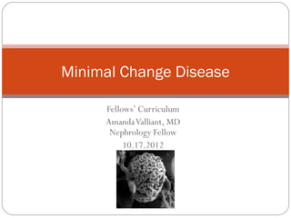 Minimal Change Disease

     Fellows’ Curriculum
     Amanda Valliant, MD
      Nephrology Fellow
          10.17.2012
 