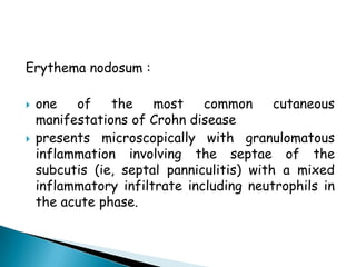 Metastatic Crohn Disease | PPT