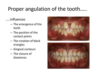 Orthodontics-Periodontics | PPTX