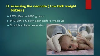  Assessing the neonate ( Low birth weight
babies )
 LBW : Below 2500 grams.
 PRETERM : Mostly born before week 38
 Small for date neonates
 