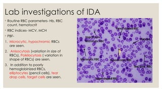 Ida Rbc Shape mchc anemia seminar.pptx mchc anemia seminar.pptx